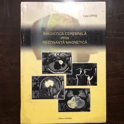 OPRIS LIGIA - IMAGISTICA CEREBRALA PRIN REZONANTA MAGNETICA