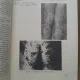 Dermatologie infantila - Scarlat Longhin