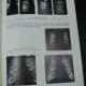 RADIOLOGIE MEDICALA BUCURESTI 1980-IOAN BIRZU