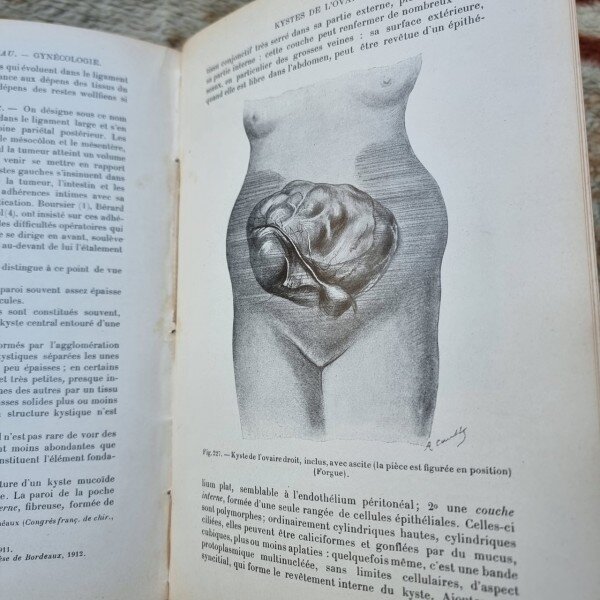 Gynecologie - Emile Forgue, Georges Massabuau XXXIV