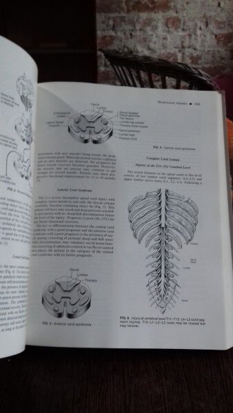 THORACOLUMBAR SPINE FRACTURES - YIZHAR FLOMAN