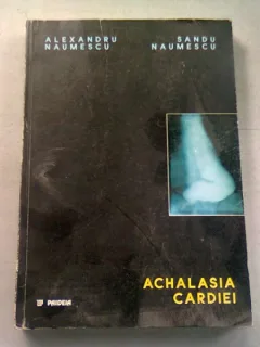 ACHALASIA CARDIEI - ALEXANDRU NAUMESCU