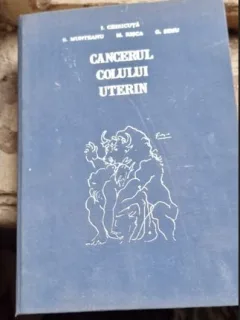 CANCERUL COLULUI UTERIN - I. CHIRICUTA
