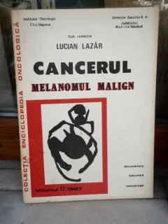 CANCERUL MELANOMUL MALIGN , LUCIAN L AZAR