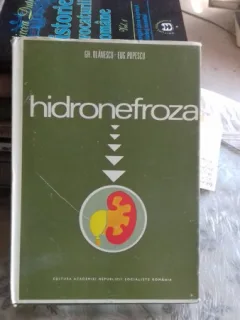 HIDRONEFROZA - GH. OLANESCU