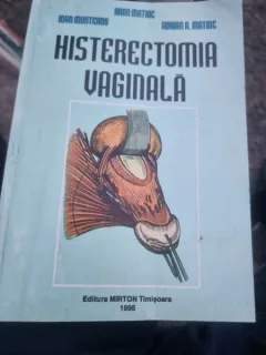 HISTERECTOMIA VAGINALA - ARON MATIOC