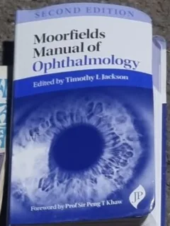 Moorfields Manual of Ophtalmology