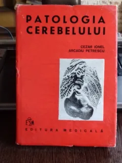 PATOLOGIA CEREBELULUI - CEZAR IONEL