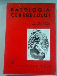 PATOLOGIA CREIERULUI - CEZAR IONEL