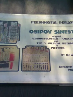PERIODONTAL DISEASES. OSIPOV - SINESTI'S ORIGINAL PARODONTOLOGICAL CONCEPTION AND THE 3 SURGICAL METHODS IN PICTURES by THE AUTHOR
