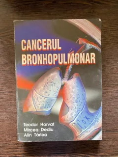 Teodor Horvat Cancerul Bronhopulmonar