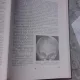 AFECTIUNI NEURO-CHIRURGICALE ALE SUGARULUI SI COPILULUI MIC (0-3 ANI) - C. ARSENI, LENKE HORVATH, A.V. CIUREA