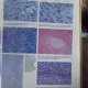 ATLAS OF GYNECOLOGIC PATHOLOGY (ATLAS DE PATOLOGIE GINECOLOGICA) - J.D. WOODRUFF