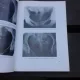 HISTEROSALPINOGRAFIA IN PRACTICA GINECOLOGICA SI OBSTETRICALA, ATLAS - PAULA CONSTANTINESCU