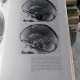 PNEUM-ENZEPHALO GRAPHISCHE ANATOMIE DES KINDERGEHIRNS - DAGOBERT MULLER (ANATOMIE GRAFICA ENCEFALOTRIGEMINALA A CREIERULUI COPILILUI)