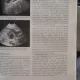 Tratat de ultrasonografie clinica vol.I - Radu I. Badea