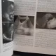 Tratat de ultrasonografie clinica vol.I - Radu I. Badea