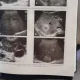 Tratat de ultrasonografie clinica vol.I - Radu I. Badea